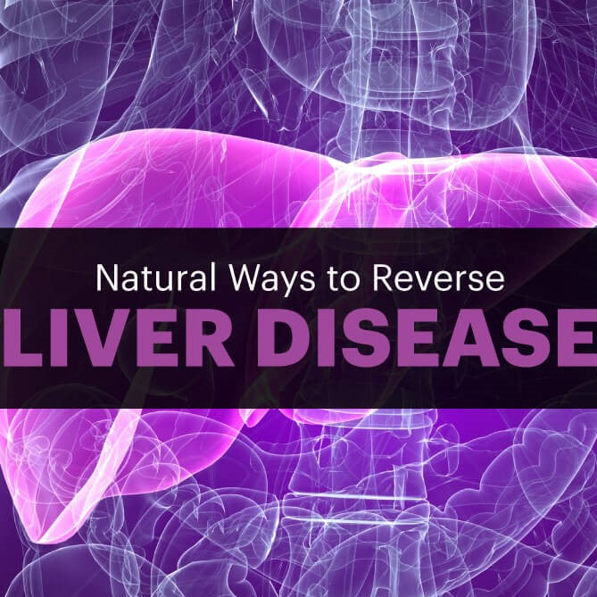 Natural Ways to Help Treat Liver Disease