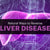 Natural Ways to Help Treat Liver Disease